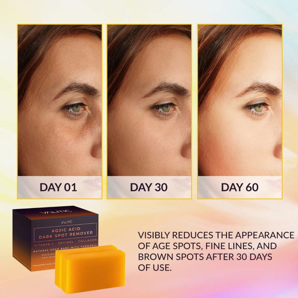 Natural Dark Spot Remover Soap with Vitamin C & Retinol (2 Pack)